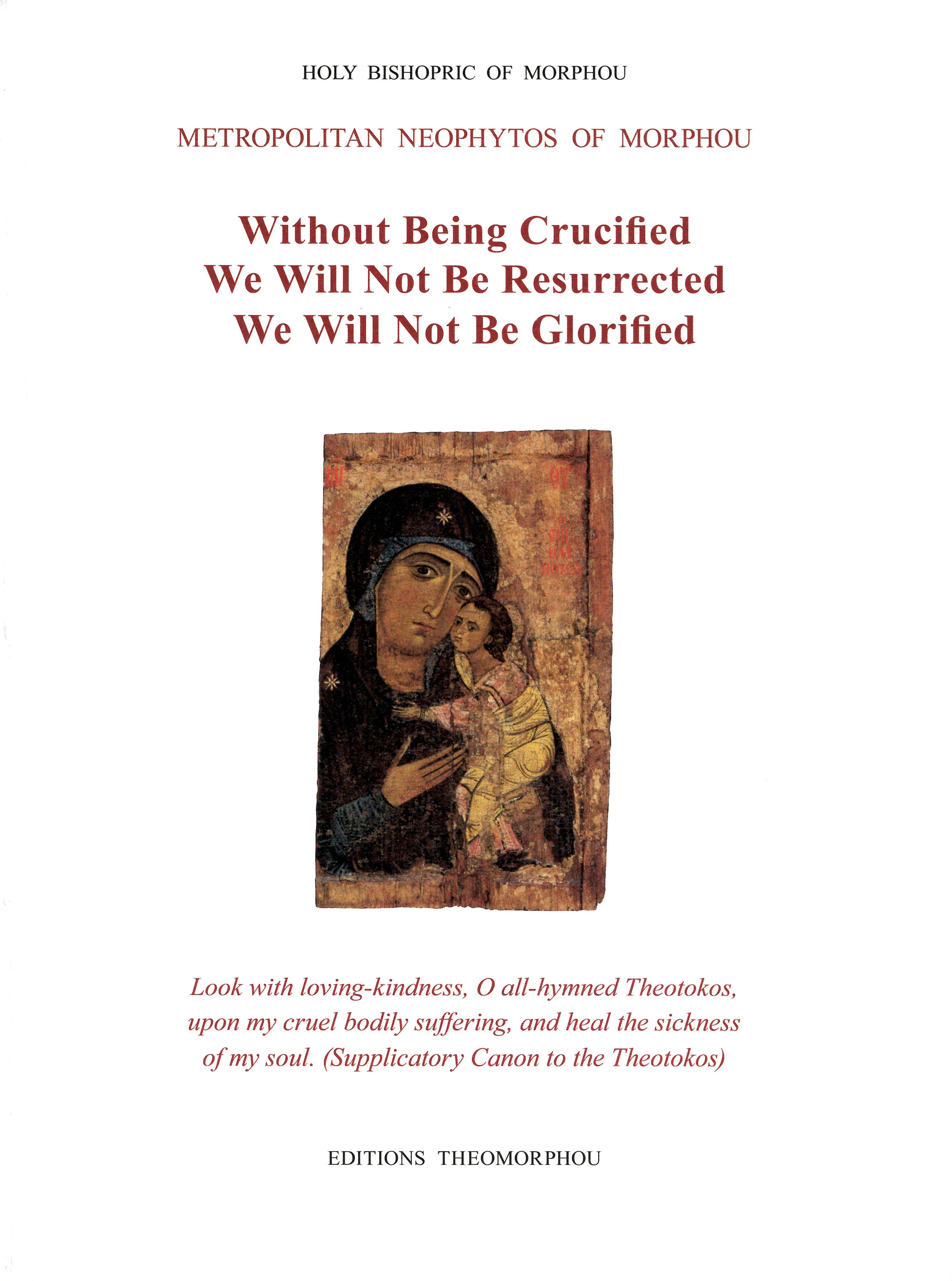 Without Being Crucified, We Will Not Be Resurrected, We Will Not Be Glorified